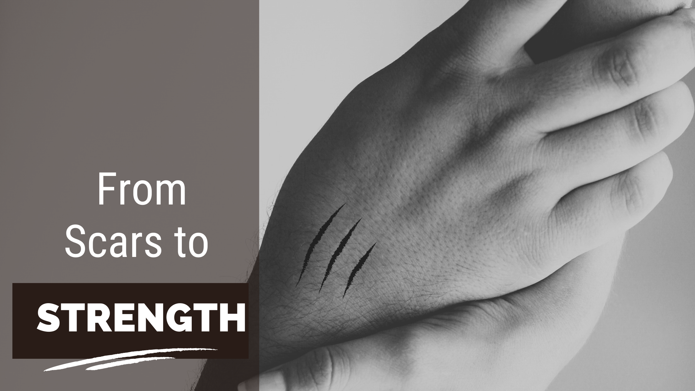 From Scars to Strength Bridgette Breaking Barriers